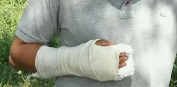 Un joven fue macheteado por su padrastro en Itá - Noticiero Paraguay