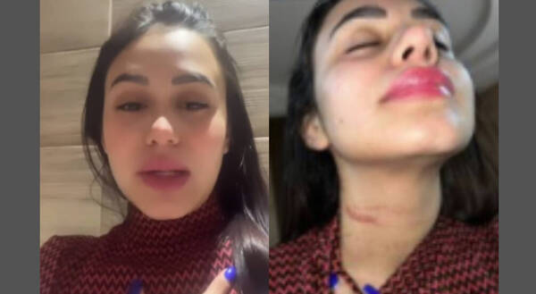Modelo paraguaya pilló a su novio "con otra" y denunció agresión