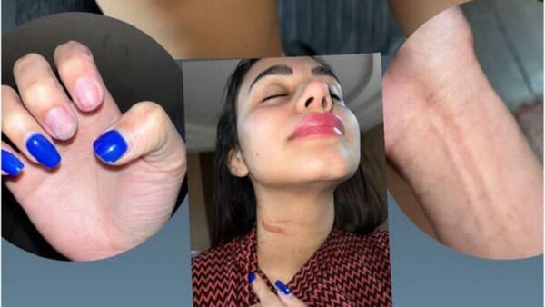 Cuerona pilló a su novio con otra y denunció a su cuñado por agresión