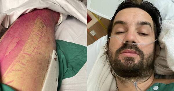 La Nación / ¿Tame Impala renuncia al Asunciónico? El líder de la banda se fracturó la cadera
