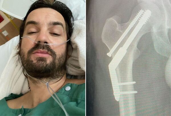 Vocalista de Tame Impala se fractura la cadera a días de su presentación en Paraguay - Megacadena — Últimas Noticias de Paraguay
