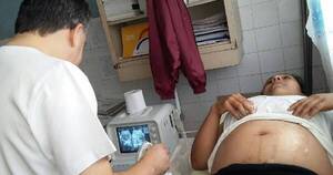 La Nación / Alertan sobre aumentode contagio de la sífilis congénita en gestantes