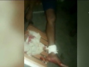 Diario HOY | Indígena intentó cazar un yacaré y fue atacado