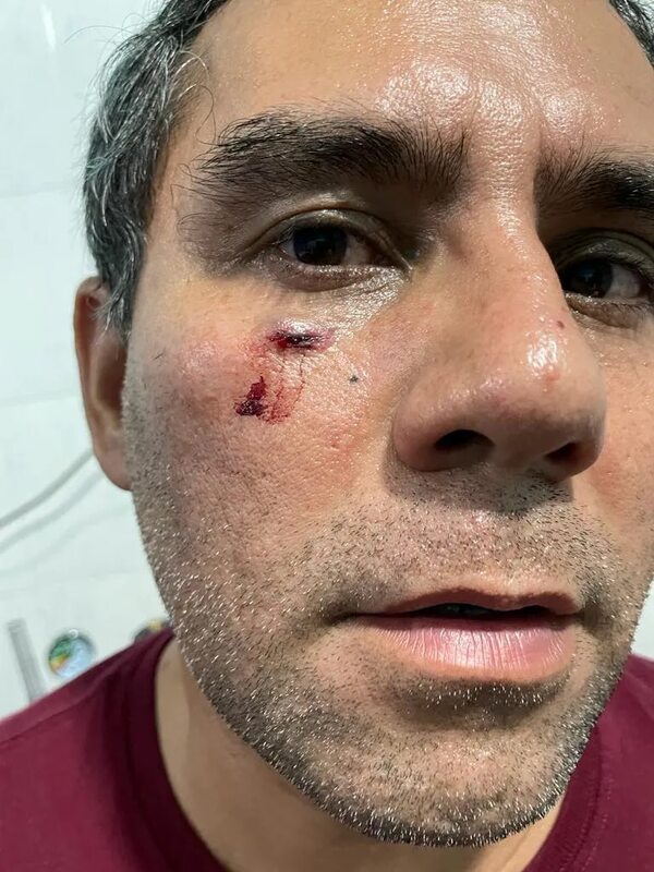 Colorados y liberales se tomaron a golpes en San Antonio - Política - ABC Color