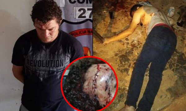 Con machete casi le partió la cabeza a su vecino tras una acalorada discusión – Diario TNPRESS