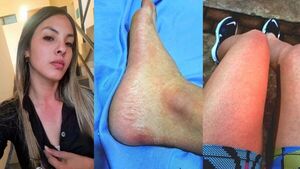 Atleta la pasó muy mal: "Chikungunya sos de lo peor"