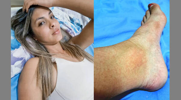 "Totalmente maltratada": Atleta sexy narró lo que le hizo la chikungunya