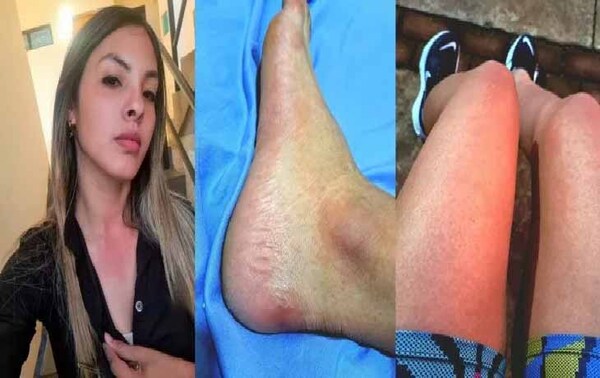 Atleta paraguaya la pasó muy mal: "Chikungunya sos de lo peor" – Prensa 5