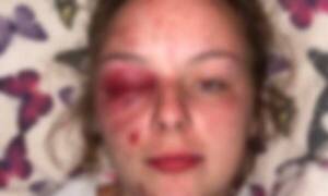 Dijo que fue abusada, los acusados pasaron un infierno ¡y todo era mentira!: ella se provocó las heridas