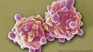 Una pastilla experimental logra remitir la leucemia avanzada en 18 pacientes
