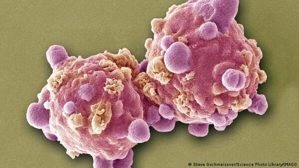 Una pastilla experimental logra remitir la leucemia avanzada en 18 pacientes