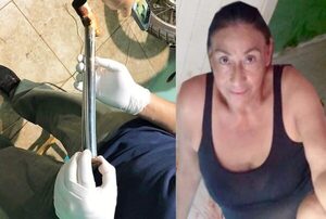 Imputan a mujer que habría asesinado con un mazo a su pareja - Noticiero Paraguay