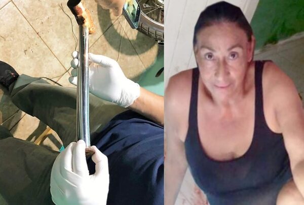 Imputan a mujer que habría asesinado con un mazo a su pareja - Noticiero Paraguay