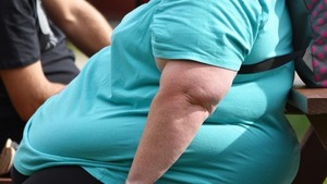 Obesidad: médicos organizan jornada científica este sábado - trece
