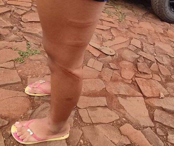 Golpeó con manguera a su hija de 13 años y ahora está imputado – Diario TNPRESS