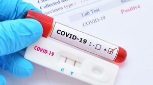 OMS revela que China guarda información sobre origen del Covid-19