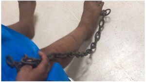 Adolescente es derivado al hospital tras pisar una cadena con gancho