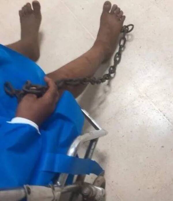 Pisó una cadena con gancho y fue a parar al hospital