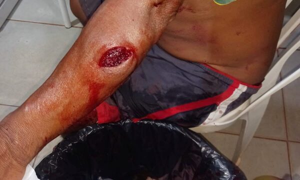 Cacique detiene a menor que apuñaló a sexagenario en comunidad indígena – Diario TNPRESS