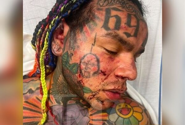 El rapero 6ix9ine fue hospitalizado tras ser atacado por un grupo en un gimnasio de Florida - Megacadena — Últimas Noticias de Paraguay