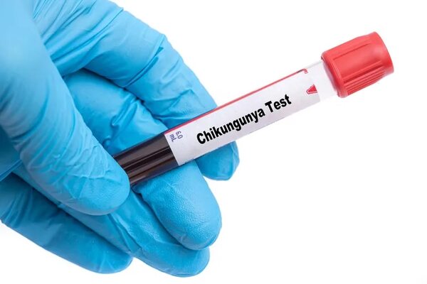 Chikunguña: Salud dice que no es necesario test positivo para solicitar reposo - Nacionales - ABC Color