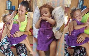 Joven madre pide ayuda para solventar gastos del tratamiento de su pequeña hija en Coronel Oviedo – Prensa 5