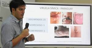La Nación / Viruela del mono: anuncian primera infección en Presidente Hayes y suman 119 casos