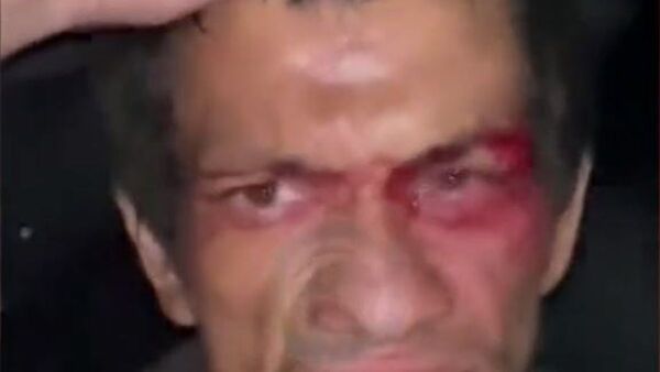 Molió a golpes a un delincuente que robaba su medidor de agua