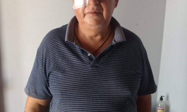 Policías raptan a empresario y golpean a su guardia en Franco