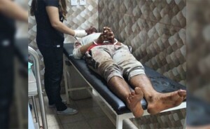 Cayó de su moto durante persecución luego de robar un celular