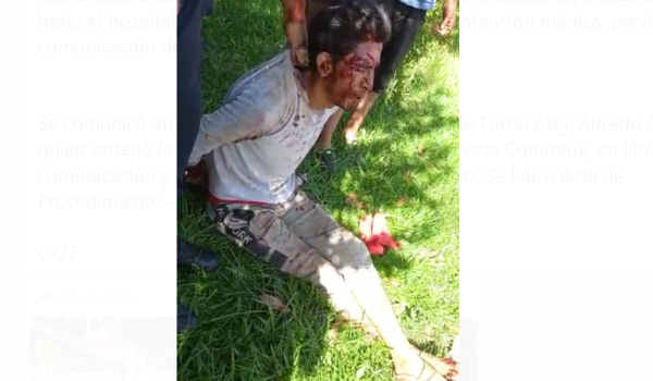 (Video). Motochorro capturado por vecinos y víctima le dijo: “te perdono lo que me hiciste”