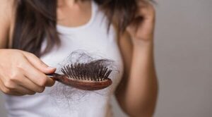Caída del cabello post chikunguña es frecuente, pero reversible