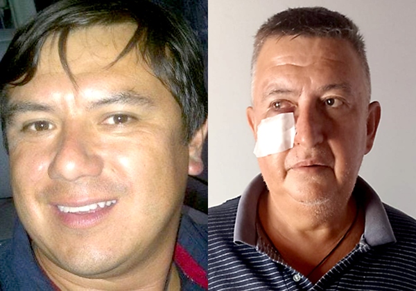 Una más de la Policía: raptan a empresario y golpean a su guardia en Pdte. Franco - La Clave