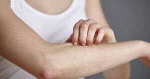 La Nación / Chikungunya: tratamiento para la caída de cabello y descamación de la piel