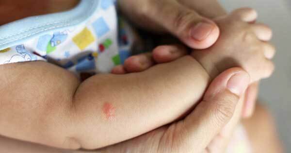 Chikungunya: instan a proteger a los bebés con repelentes desde los dos meses - trece