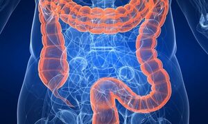 Recuerdan el día mundial de la Lucha contra el Cáncer de Colon