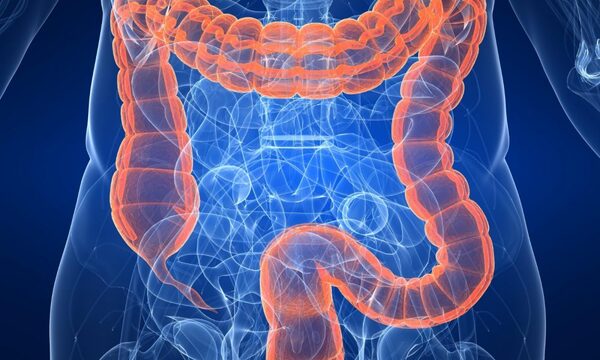 Recuerdan el día mundial de la Lucha contra el Cáncer de Colon