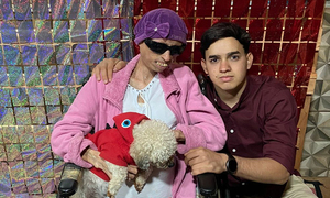 Coronel Oviedo: Organizan pollada a beneficio de paciente con esclerodermia - OviedoPress