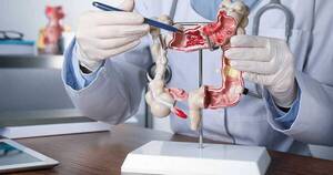 La Nación / Cáncer colorrectal: una enfermedad que afecta cada vez más a personas menores de 50 años