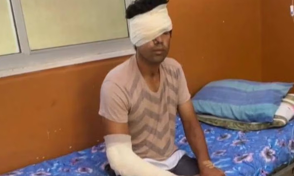 Nativos adictos machetearon a joven para robarle dinero en Concepción - OviedoPress