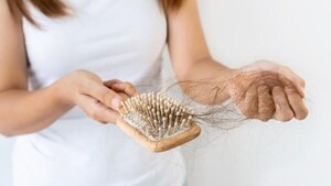 Especialista afirma que caída del cabello pos chikungunya es frecuente, pero reversible - .::Agencia IP::.
