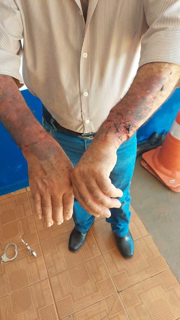 Taxista fue asaltado y dejado esposado a un árbol - Radio Imperio