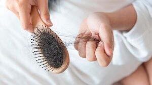 Chikungunya: Registran lesión en la piel y caída de cabello en pacientes