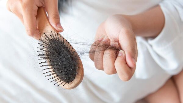 Chikungunya: Registran lesión en la piel y caída de cabello en pacientes