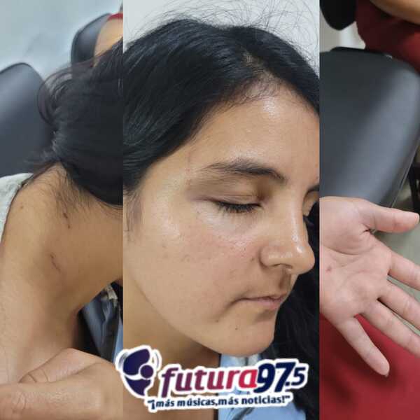 Mujer es victima de brutal golpiza por parte de su pareja