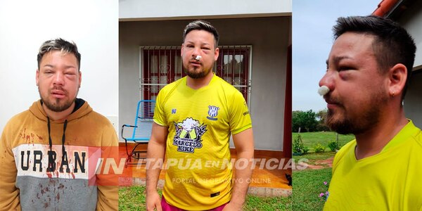 JOVEN DENUNCIÓ QUE UN MILITAR LO MOLIÓ A GOLPES EN SAN JUAN DEL PARANÁ - Itapúa Noticias