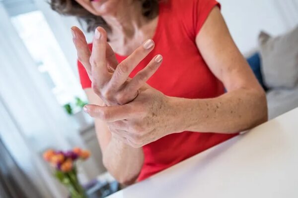 Proponen recurrir a remedios yuyos para tratar problemas articulares - Nacionales - ABC Color