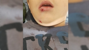 Niño pierde varios dientes tras recibir un disparo en Alto Verá