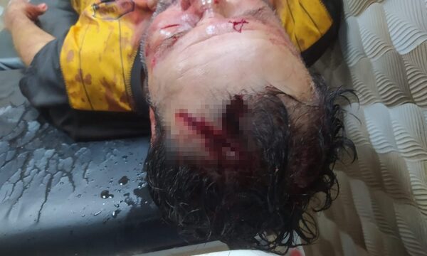 Pelea entre amigos pescadores termina con un acuchillado y otro apaleado en Hernandarias – Diario TNPRESS
