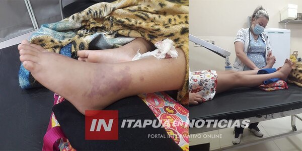 NIÑA DE 9 AÑOS ES INTERNADA EN HOSPITAL REGIONAL TRAS SUFRIR PICADURA DE RAYA - Itapúa Noticias